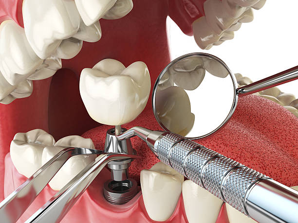 Best Emergency Dental Surgery in Medfd, OR